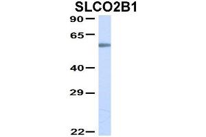 Host:  Rabbit  Target Name:  SLCO2B1  Sample Type:  Human Fetal Lung  Antibody Dilution:  1.