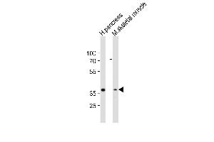 Western blot analysis of lysates from human pancreas, mouse skeletal muscle tissue lysate (from left to right), using B4GALT7 Antibody (C-term) (ABIN6243577 and ABIN6577900). (B4GALT7 anticorps  (C-Term))