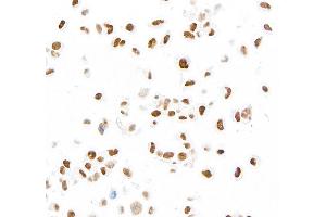 Immunocytochemistry (ICC) image for anti-MutS Homolog 6 (E. Coli) (MSH6) (AA 1310-1360) antibody (ABIN7455152) (Recombinant MSH6 anticorps  (AA 1310-1360))