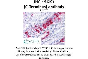 Image no. 1 for anti-serum/glucocorticoid Regulated Kinase Family, Member 3 (SGK3) (C-Term) antibody (ABIN1739226)