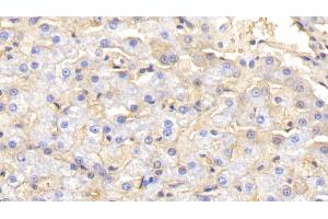 Detection of HB in Canine Liver Tissue using Polyclonal Antibody to Hemoglobin (HB) (Hemoglobin anticorps)