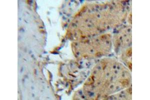 Used in DAB staining on fromalin fixed paraffin-embedded Stomach tissue (SIRT2 anticorps  (AA 65-340))