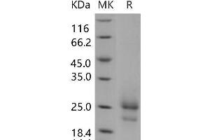 Western Blotting (WB) image for Thymic Stromal Lymphopoietin (TSLP) (Active) protein (His tag) (ABIN7198241)