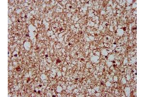 IHC image of ABIN7149368 diluted at 1:400 and staining in paraffin-embedded human brain tissue performed on a Leica BondTM system. (CKAP5 anticorps  (AA 1802-2019))