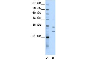 WB Suggested Anti-BXDC5 Antibody Titration:  0. (RPF1 anticorps  (N-Term))