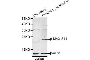 Western blot analysis of extracts of Jurkat cells, using Phospho-MAX-S11 antibody (ABIN5969917) at 1/1000 dilution. (MAX anticorps  (pSer11))