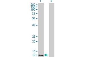Western Blot analysis of S100A4 expression in transfected 293T cell line by S100A4 monoclonal antibody (M01), clone 1F12-1G7. (s100a4 anticorps  (AA 1-101))