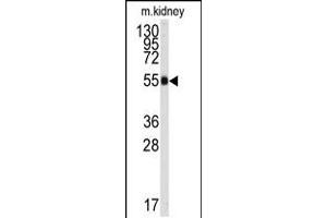 Western blot analysis of anti-ALDH9A1 Antibody in mouse kidney tissue lysates (35ug/lane). (ALDH9A1 anticorps  (C-Term))