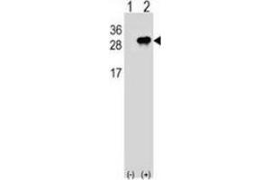 Western blot analysis of Interleukin-28B (arrow) using rabbit polyclonal Interleukin-28B  (N-term): 293 cell lysates (2ug/lane) either nontransfected (Lane 1) or transiently transfected (Lane 2) with the IL28B gene. (IL28B anticorps  (N-Term))