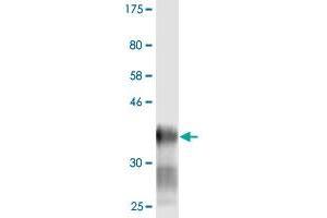 Western Blot detection against Immunogen (38. (LY6H anticorps  (AA 26-140))