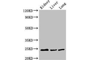 Western Blot Positive WB detected in: Mouse kidney tissue, Mouse liver tissue, Rat lung tissue All lanes: RAB5A antibody at 3 μg/mL Secondary Goat polyclonal to rabbit IgG at 1/50000 dilution Predicted band size: 24, 23 kDa Observed band size: 24 kDa (RAB5 anticorps  (AA 1-215))