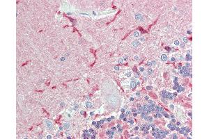 Anti-CADM2 antibody IHC of human brain, cerebellum.