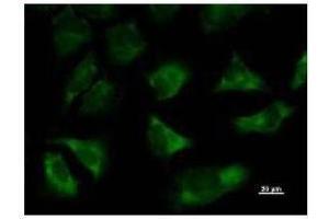 anti-threonyl-tRNA Synthetase (TARS) antibody