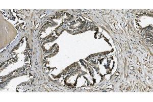 IHC analysis of GRSF1 using anti-GRSF1 antibody (ABIN7599803). (GRSF1 anticorps  (AA 119-405))