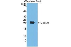 Detection of Recombinant JAM2, Human using Polyclonal Antibody to Junctional Adhesion Molecule 2 (JAM2)