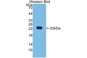 Detection of Recombinant JAM2, Human using Polyclonal Antibody to Junctional Adhesion Molecule 2 (JAM2) (JAM2 anticorps  (AA 74-250))