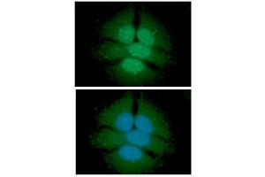 ICC/IF analysis of UGDH in HeLa cells line, stained with DAPI (Blue) for nucleus staining and monoclonal anti-human UGDH antibody (1:100) with goat anti-mouse IgG-Alexa fluor 488 conjugate (Green).