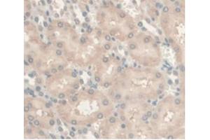 DAB staining on IHC-P, Samples: Rat Kidney Tissue. (Androgen Receptor anticorps  (AA 491-679))