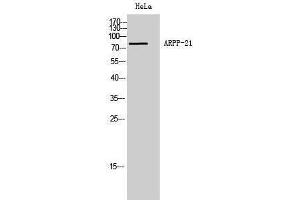 Western Blotting (WB) image for anti-cAMP-Regulated phosphoprotein, 21kDa (ARPP21) (Internal Region) antibody (ABIN3183376)