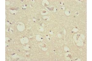 Immunohistochemistry of paraffin-embedded human brain tissue using ABIN7147410 at dilution of 1:100