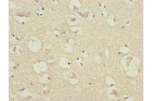 Immunohistochemistry of paraffin-embedded human brain tissue using ABIN7147410 at dilution of 1:100 (CEP57 anticorps  (AA 1-240))