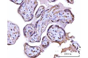 IHC analysis of RRP1 using anti-RRP1 antibody (ABIN7600683). (RRP1 anticorps  (AA 22-237))