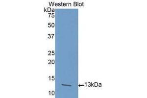 Western Blotting (WB) image for anti-Activin A Receptor, Type IB (ACVR1B) (AA 24-126) antibody (ABIN1175506)