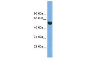 Image no. 1 for anti-Epoxide Hydrolase 1, Microsomal (Xenobiotic) (EPHX1) (AA 35-84) antibody (ABIN6745051) (EPHX1 anticorps  (AA 35-84))