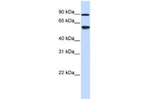 WB Suggested Anti-ADHFE1 Antibody Titration: 0. (ADHFE1 anticorps  (Middle Region))