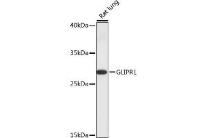 Western blot analysis of extracts of rat lung, using GLIPR1 antibody (ABIN7267387) at 1:1000 dilution. (GLIPR1 anticorps  (AA 22-140))