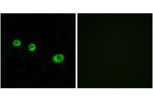 Immunofluorescence analysis of MCF7 cells, using GBP1 Antibody. (GBP1 anticorps  (AA 71-120))