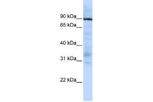 WB Suggested Anti-EWSR1 Antibody Titration:  0. (EWSR1 anticorps  (Middle Region))