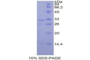 SDS-PAGE (SDS) image for Mitogen-Activated Protein Kinase Kinase 3 (MAP2K3) (AA 99-343) protein (His tag) (ABIN2125918) (MAP2K3 Protein (AA 99-343) (His tag))