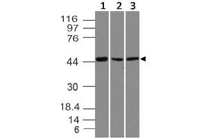 Image no. 1 for anti-SRY (Sex Determining Region Y)-Box 11 (SOX11) (AA 23-236) antibody (ABIN5027536) (SOX11 anticorps  (AA 23-236))