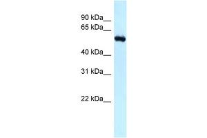 WB Suggested Anti-Rbbp5 Antibody Titration: 1. (RBBP5 anticorps  (N-Term))