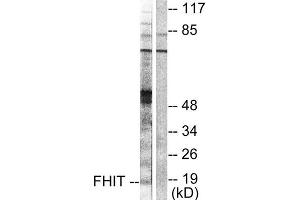 Western Blotting (WB) image for anti-Fragile Histidine Triad (FHIT) (Internal Region) antibody (ABIN1848544)