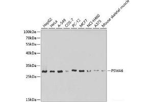 Western blot analysis of extracts of various cell lines using PSMA6 Polyclonal Antibody at dilution of 1:1000. (PSMA6 anticorps)
