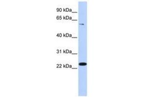 Image no. 1 for anti-Zinc Finger Protein 460 (ZNF460) (AA 36-85) antibody (ABIN6741086) (ZNF460 anticorps  (AA 36-85))