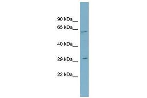 SRD5A2 antibody used at 1 ug/ml to detect target protein.