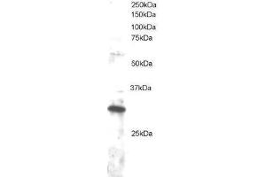 Image no. 1 for anti-Dickkopf Homolog 4 (Xenopus Laevis) (DKK4) (C-Term) antibody (ABIN374183) (DKK4 anticorps  (C-Term))