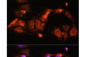 Immunofluorescence analysis of C6 cells using GCSH Polyclonal Antibody at dilution of 1:100 (40x lens).