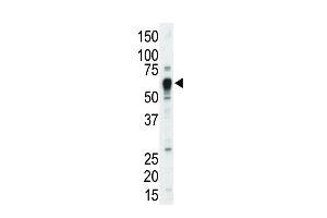 Western blot analysis of anti-TEC Pab (ABIN392111 and ABIN2841862) in mouse liver tissue lysate.