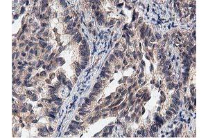 Image no. 2 for anti-Acyl-CoA Thioesterase 12 (ACOT12) antibody (ABIN1496414) (ACOT12 anticorps)