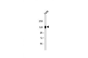 Western Blot at 1:8000 dilution + Hela whole cell lysate Lysates/proteins at 20 ug per lane. (Cadherin anticorps  (C-Term))