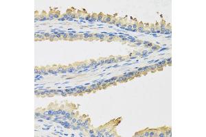 Immunohistochemistry of paraffin-embedded human prostate using LEP antibody (ABIN5973313) at dilution of 1/100 (40x lens). (Leptin anticorps)