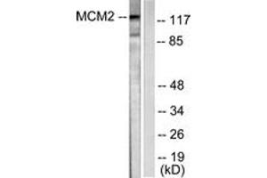 Western blot analysis of extracts from 293 cells, using MCM2 Antibody. (MCM2 anticorps  (AA 1-50))