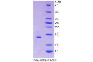 SDS-PAGE (SDS) image for Angiopoietin 4 (ANGPT4) (AA 271-491) protein (His tag) (ABIN1078794)