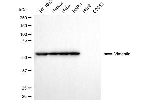 Western blotting analysis using vimentin antibody (ABIN7800838).