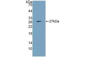Detection of Recombinant IGSF16, Human using Polyclonal Antibody to CD300 Antigen Like Family Member C (CD300c) (CD300c anticorps  (AA 21-183))
