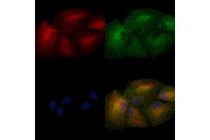 ABIN6257106 and ABIN6275018 staining  cells by IF/ICC. (CLDN8 anticorps  (C-Term))